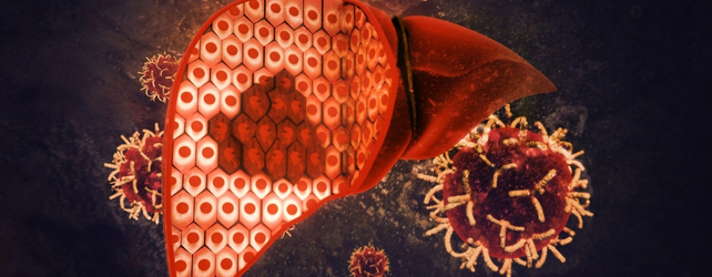 hepatitis illustration