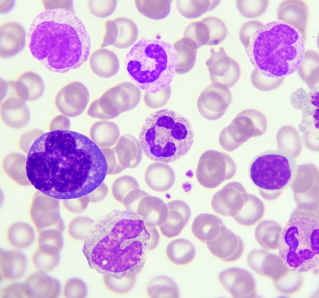 white blood cells under a microscope
