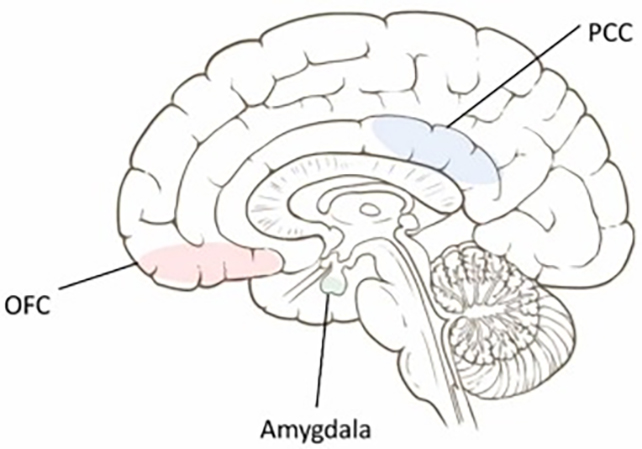 Brain diagram