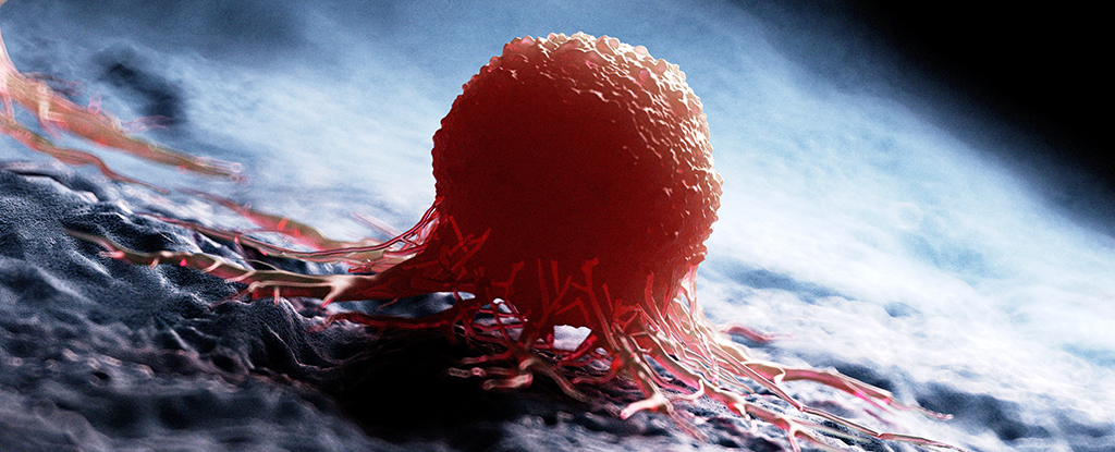 ‘Universal’ Cancer Vaccine Destroys Resistant Tumors in Mice : ScienceAlert