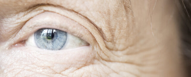 Eye wrinkles