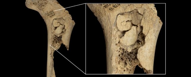 Photo of a femur bone, with a zoomed inset showing crush marks