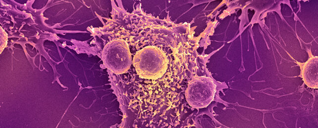 The immune system fighting cancer