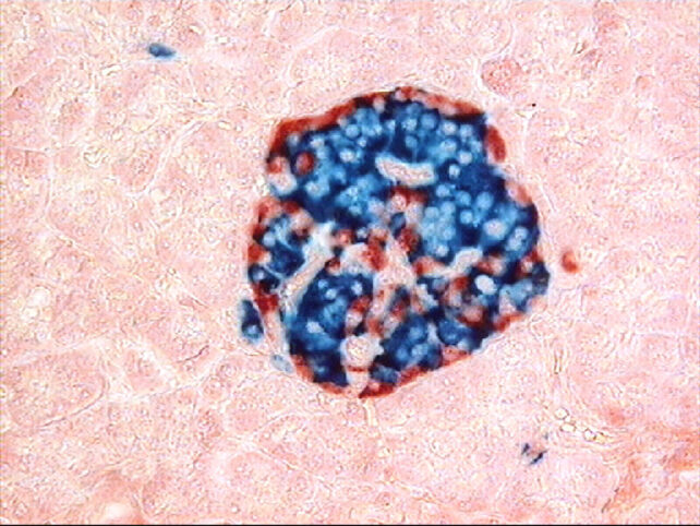 Islet Cells