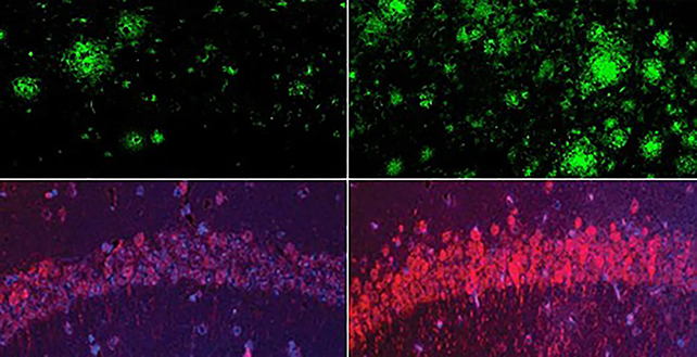 Lithium deficiency images