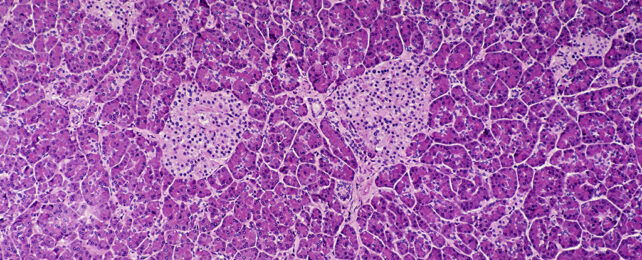 Pancreatic cells