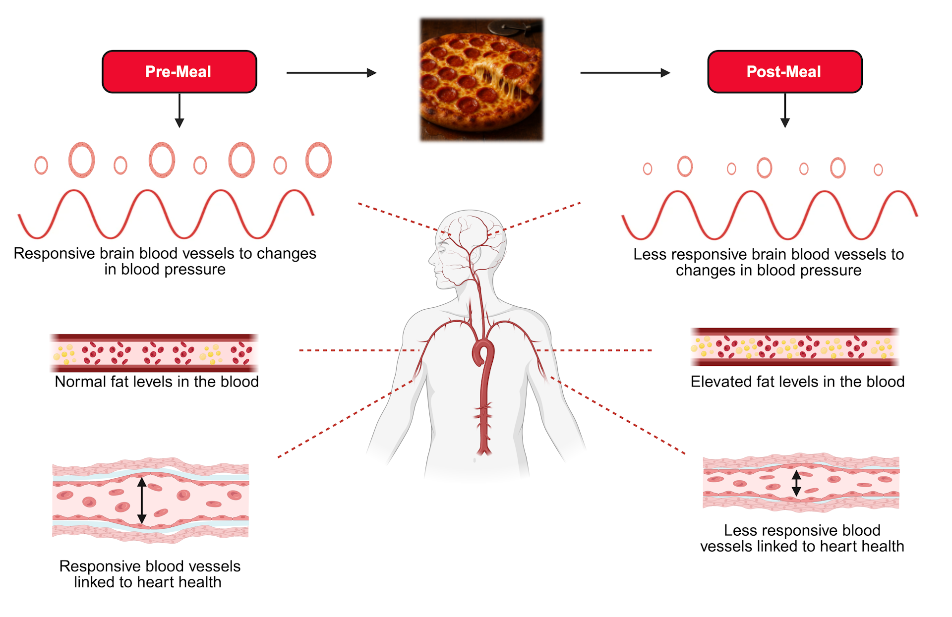 Diagram showing how fat can stiffen arteries