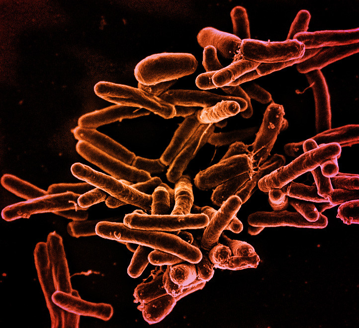 Tuberculosis particles under a microscope