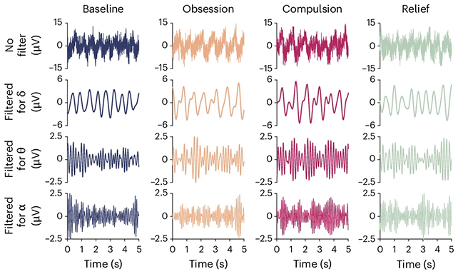 Brain waves chart