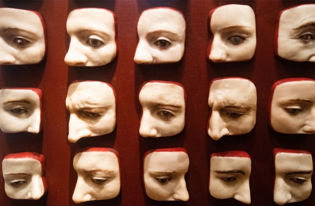 Wax moldings of eye diseases, shown in side views of human faces on a red background