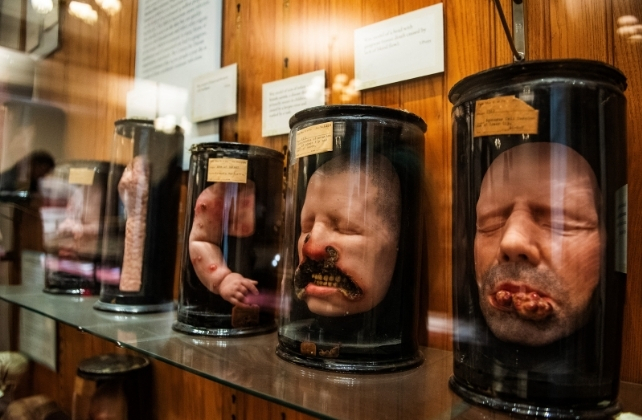Wax moldings of faces and body parts, in jars at a museum