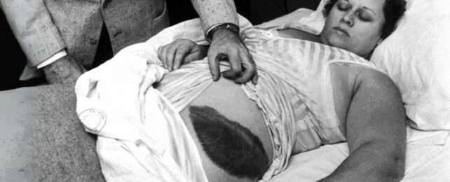 First Recorded Human Meteorite Strike Still a Wild Tale 70 Years on