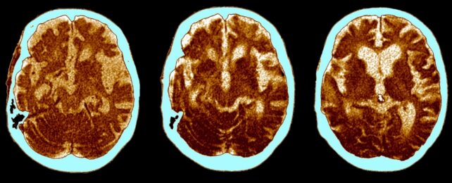 ct scans of patient brain
