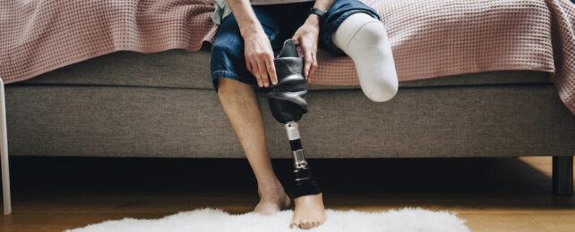 'Phantom Limbs' May Not Be What We Thought, Surprising Study Finds