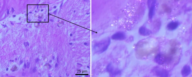 photo of brain tissue with nanoplastic