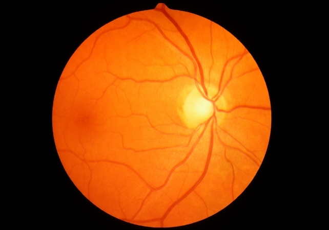 retina image
