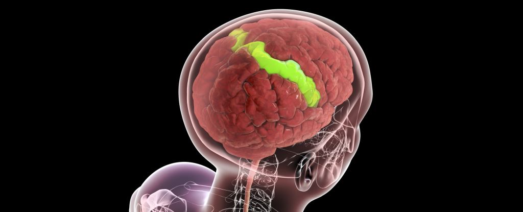Some Layers of Your Brain Actually Get Stronger as You Age : ScienceAlert