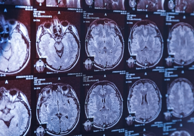 brain scans