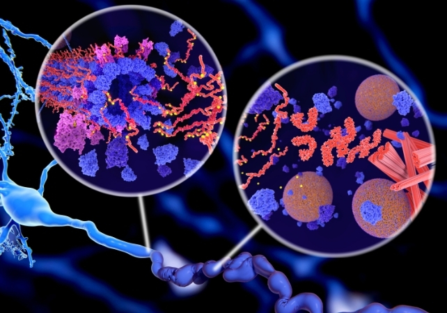 Trial to Transform Alzheimer's Diagnosis Launched in UK