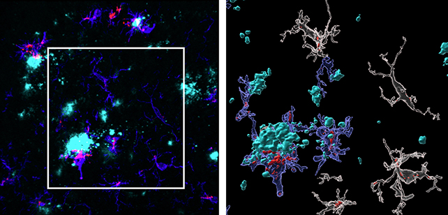 Brain cell analysis