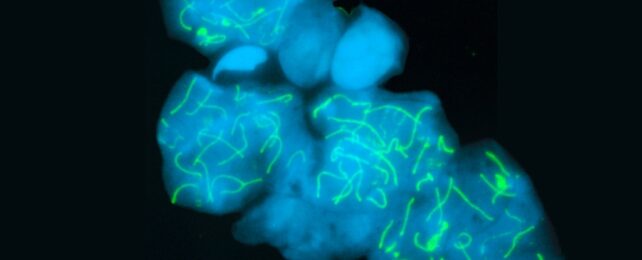 Blue stained DNA and green stained chromosome protein structure complex