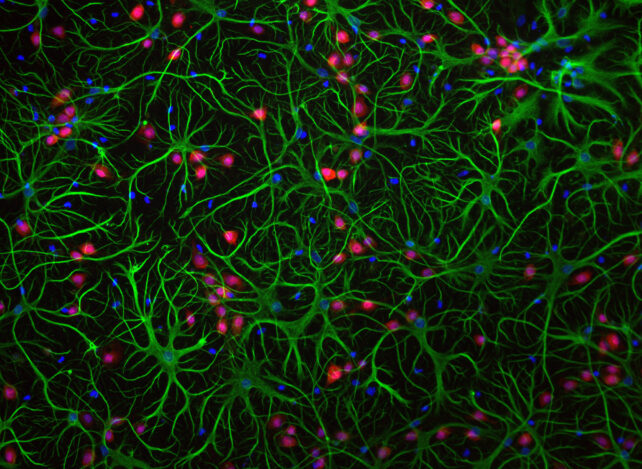 Green astrocytes, red nucleated neurons and blue nucleated other cell types