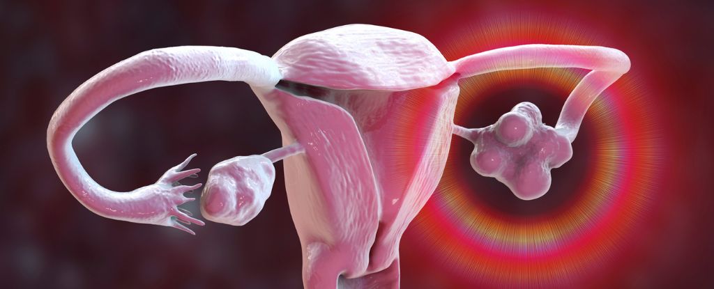www.sciencealert.com image