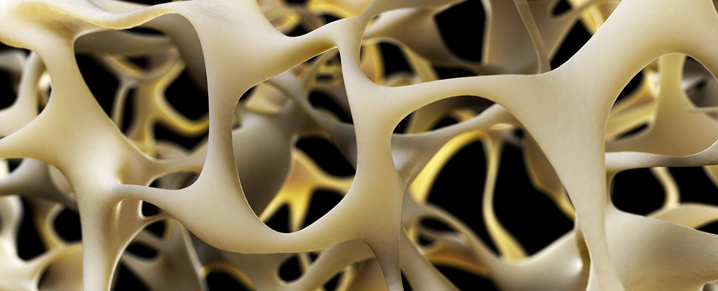 New Breakthrough to Strengthen Bones Could Reverse Osteoporosis : ScienceAlert