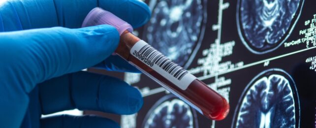 blood tube and brain scans