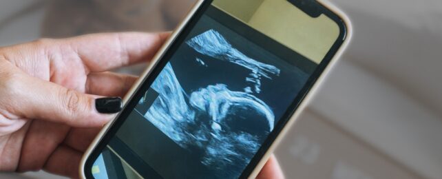 ultrasound of a baby on a phone