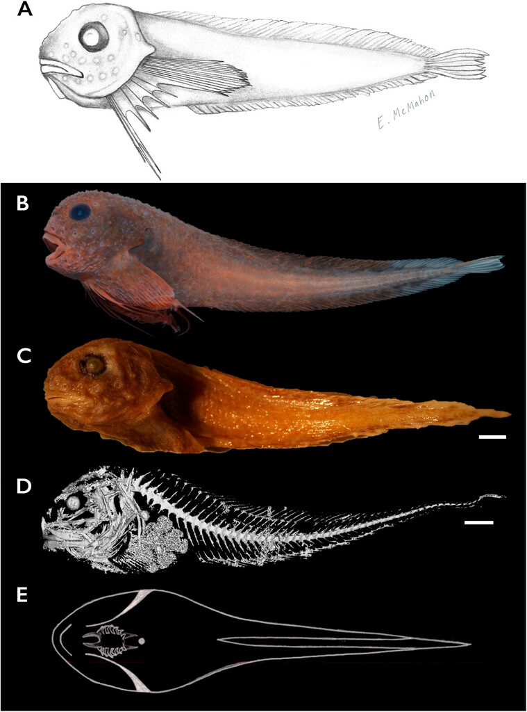 side-on images of the bumpy snailfish, in the following forms: biological illustration, fresh specimen, preserved specimen, micro-CT scan of showing bones, and a ventral view drawing