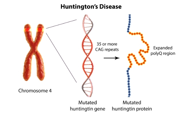 huntington's gene