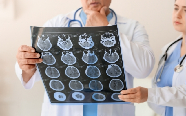 mri scan