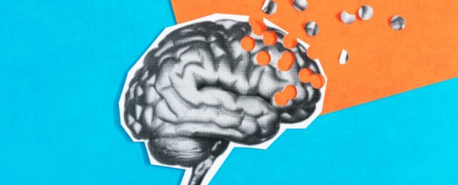 brain with holes