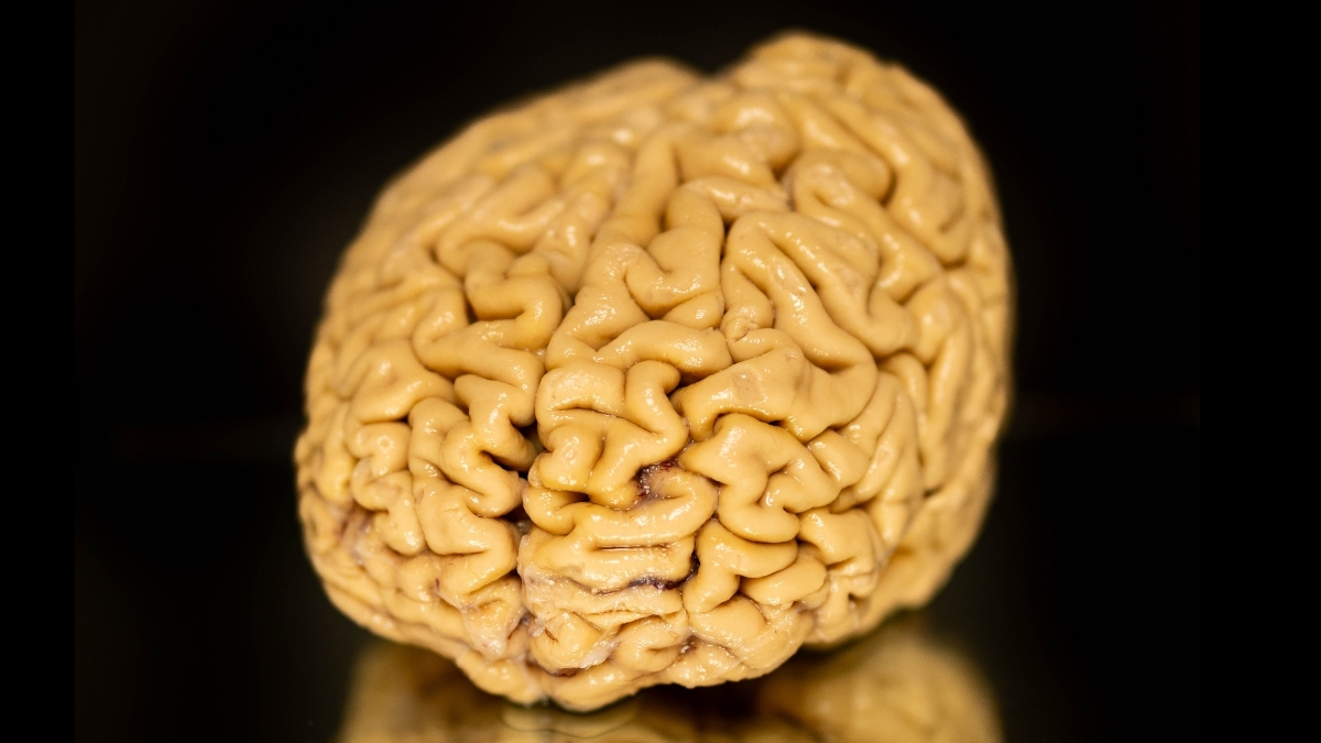 ‘Superager’ Brains Defy Cognitive Decline. We Finally Know Their Secret. : ScienceAlert ‘Superager’ Brains Defy Cognitive Decline. We Finally Know Their Secret. : ScienceAlert