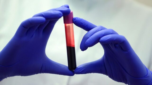 Blood of Exceptionally Long-Lived People Reveals Crucial Differences