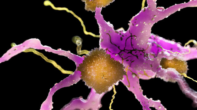 New Alzheimer's Treatment Clears Plaques From Brains of Mice Within Hours