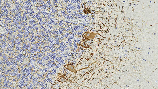 Brain cells illustration
