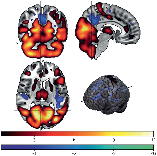 Brain structure