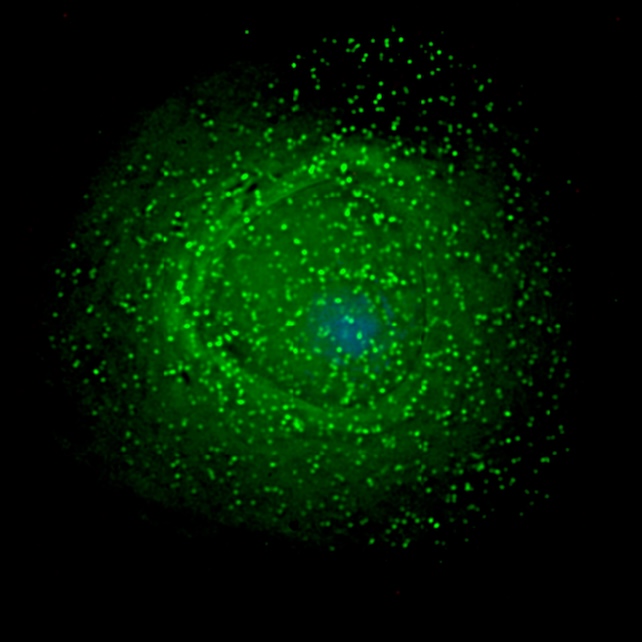 microscopic image of HIV on the surface of an infected macrophage