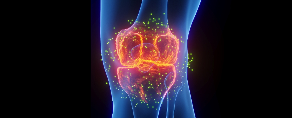 The Best Medicine For Joint Pain Isn’t What You Think, Expert Says : ScienceAlert