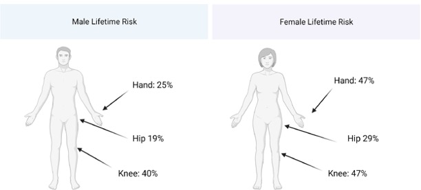 Outlines of two bodies, male and female, showing osteoarthritis risk in hand, hip, and knee.
