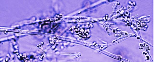 Bandages Made From Living Fungi Could Be The Future of Wound Healing