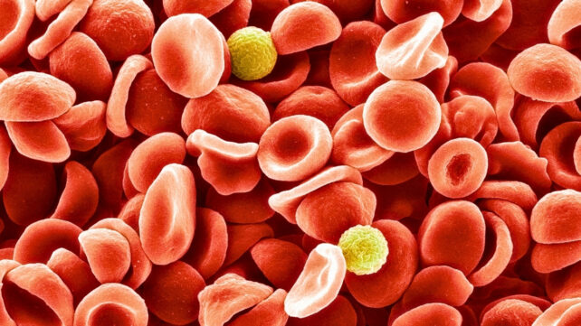 human red blood cells under microscope with two white blood cells
