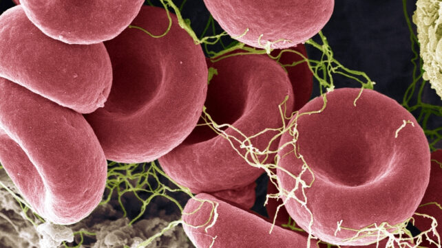 Can a New Blood Test Actually Detect ME/CFS? Here's What We Know