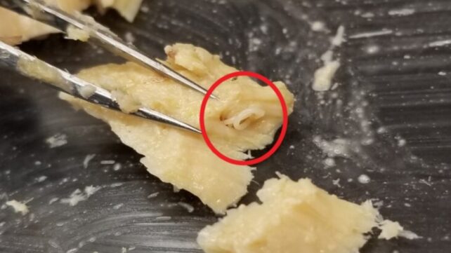 A photo of an anisakid worm — circled in red — in a canned salmon fillet.