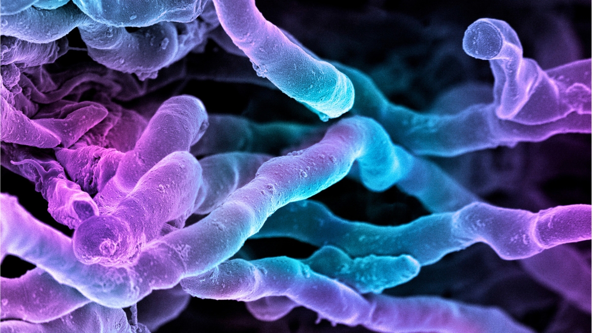 Coloured scanning electron micrograph of strands of Streptomyces coelicoflavus bacteria
