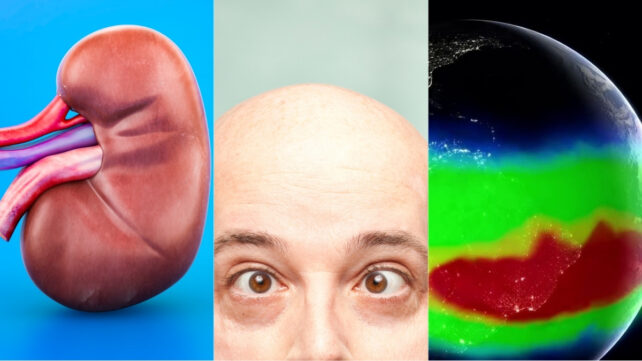 This Week in Science: 'Universal' Kidney, Earthly Anomaly, And Much More!