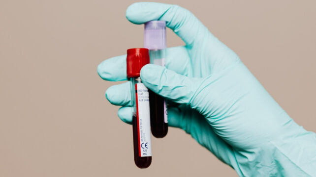 hand holding blood tubes