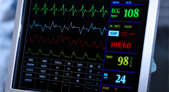 cardiac readout